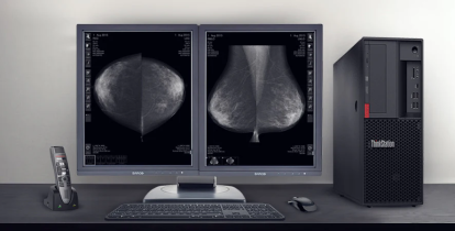7 consideratii la alegerea unui ecran pentru mamografie