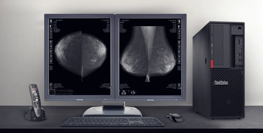 7 consideratii la alegerea unui ecran pentru mamografie