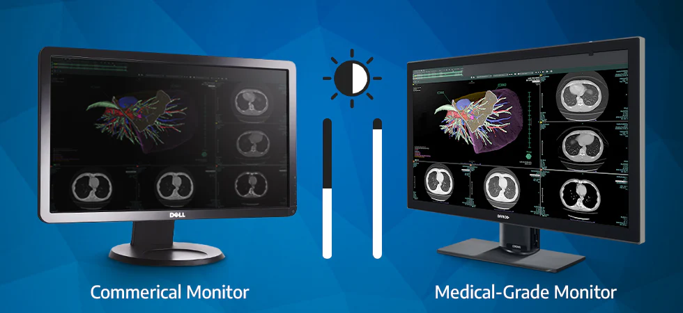 de ce radiologii ar trebui sa foloseasca ecrane de diagnostic medical pentru a interpreta radiografii