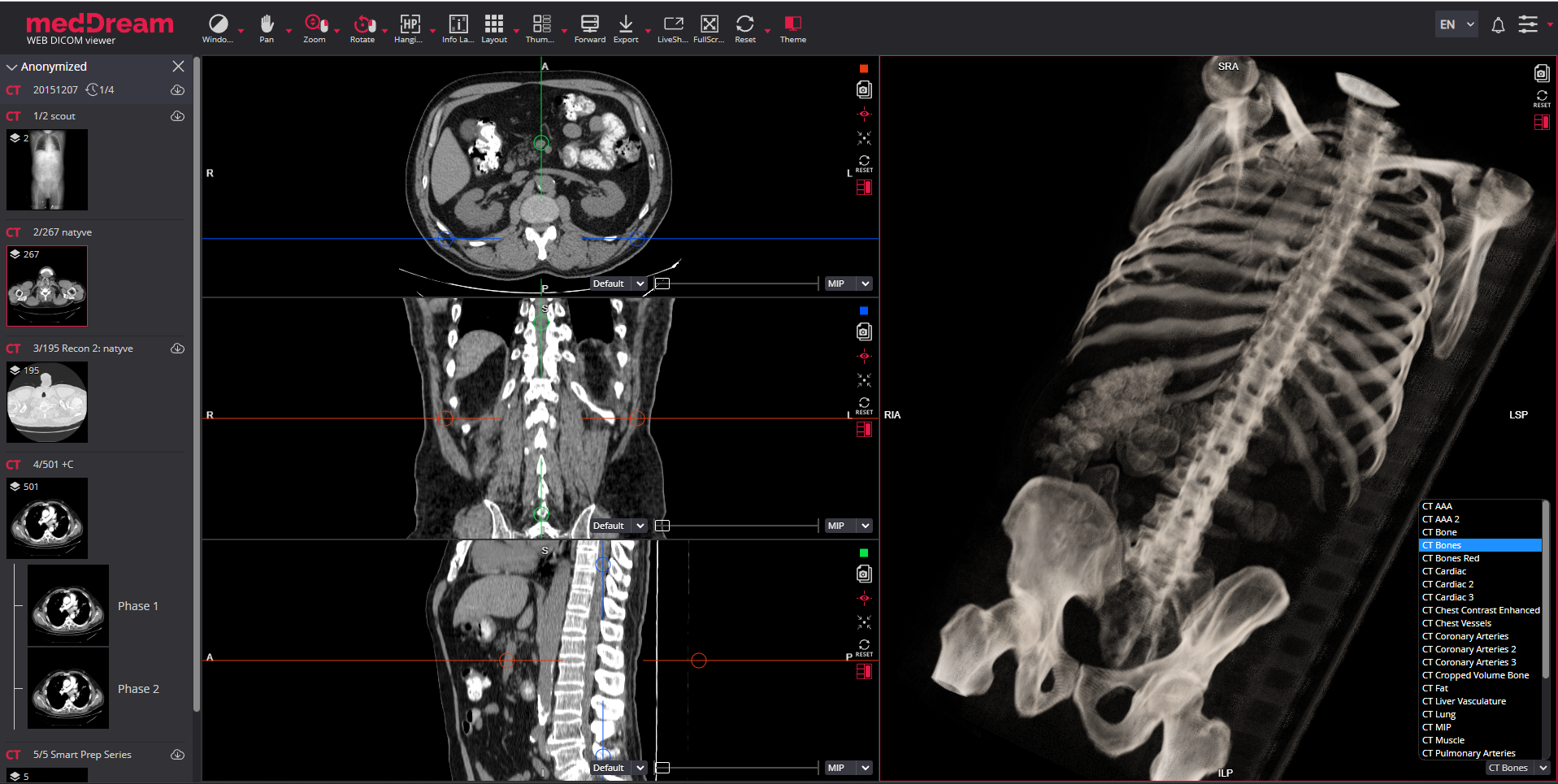 dicom viewer mist oblique 3d
