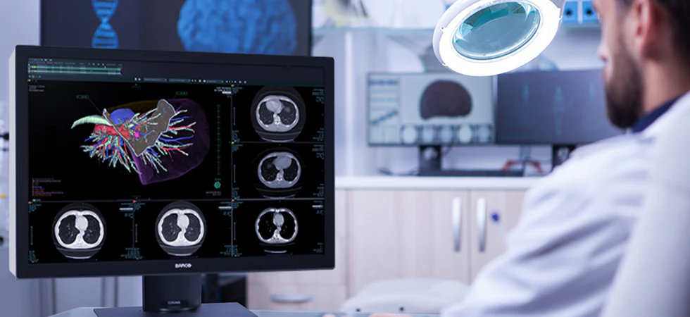 De ce radiologii ar trebui sa foloseasca ecrane de diagnostic medical pentru a interpreta radiografii?