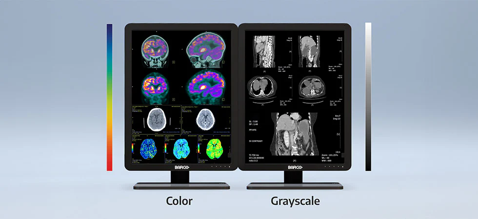 how to choose the right diagnostic display and pacs workstation 5