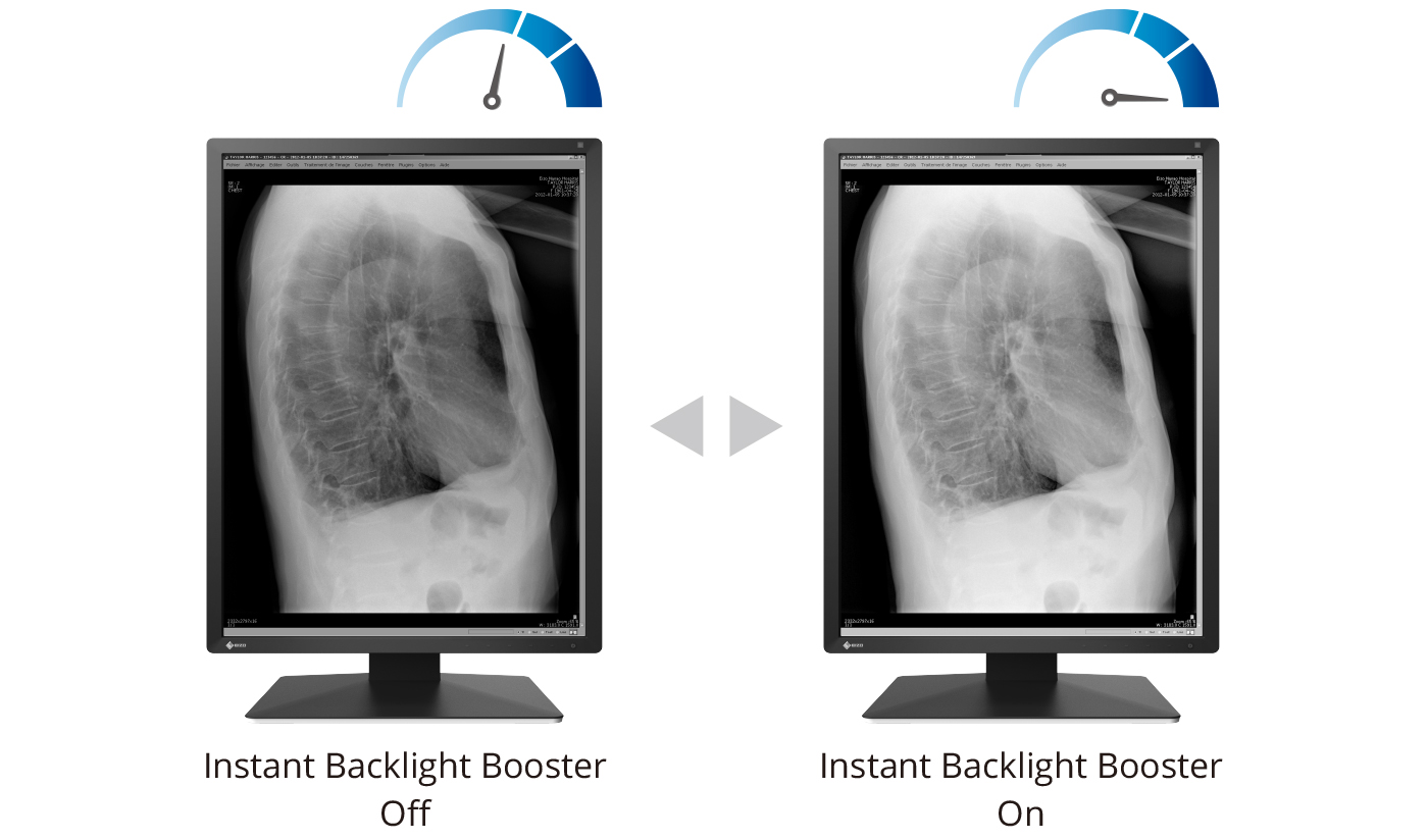 instant backlight booster en