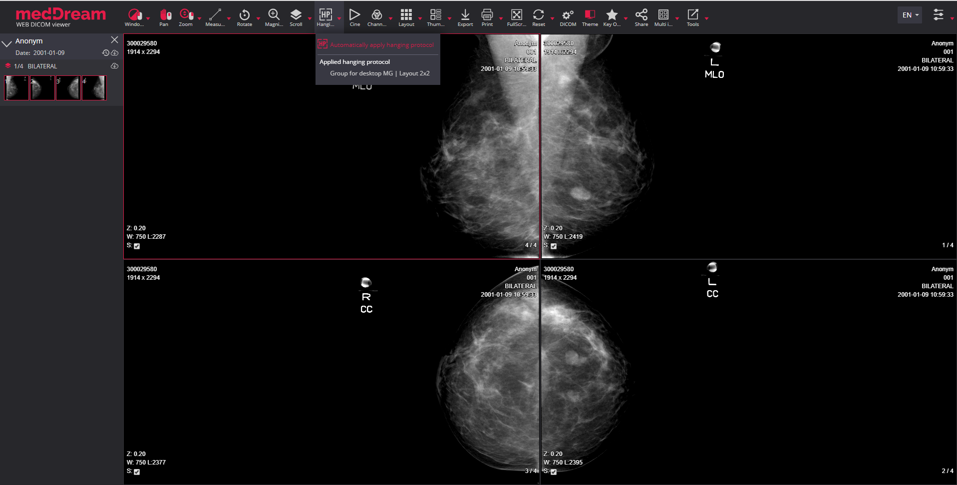 meddream dicom viewer hanging protocols 1