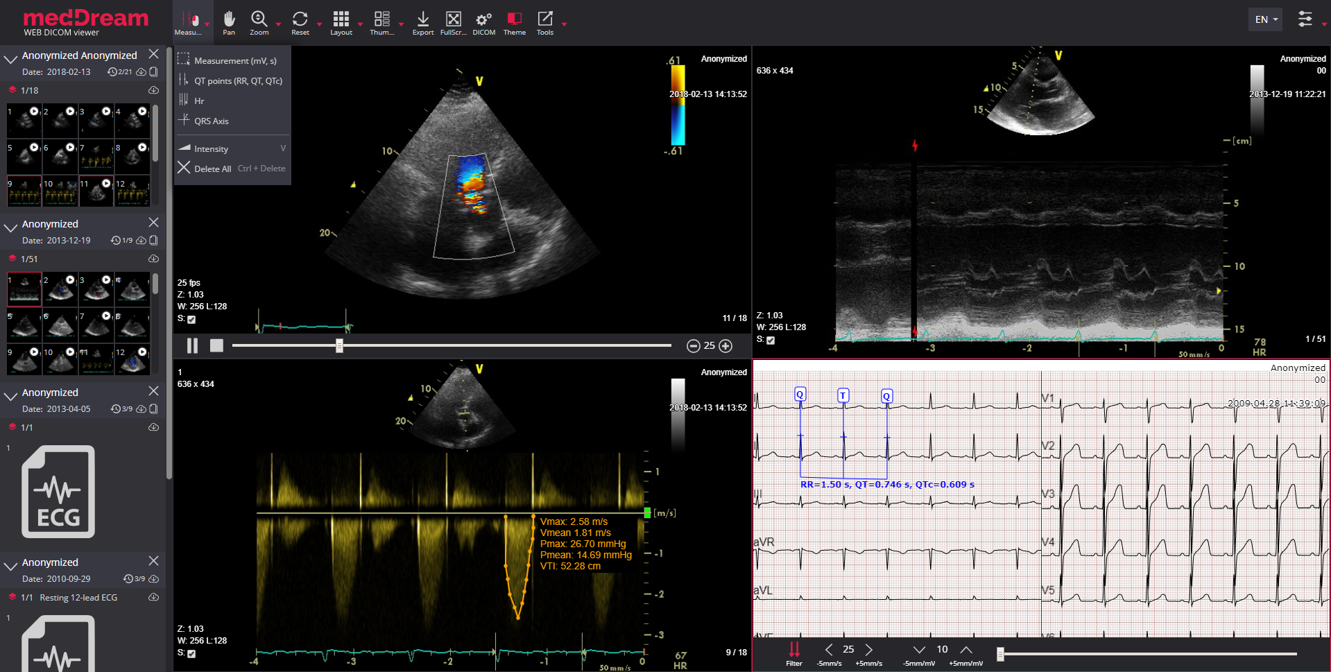 meddream web dicom viewer ecg and us