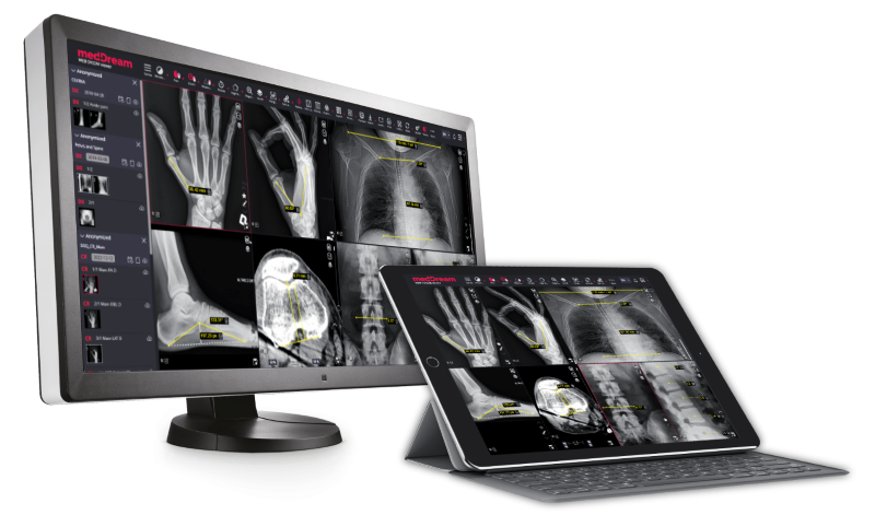 meddream web dicom viewer for orthopedy