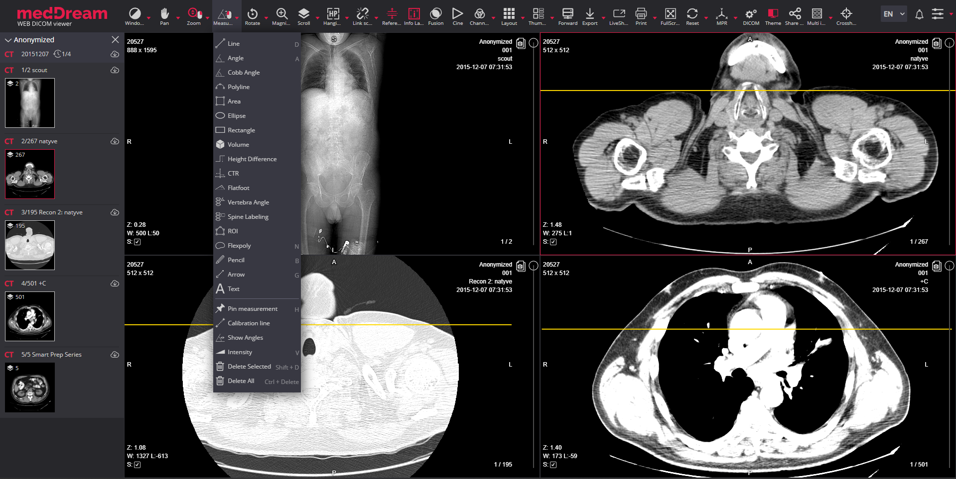meddream web dicom viewer measurements