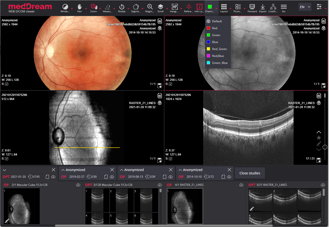 ophthalmology viewer meddream