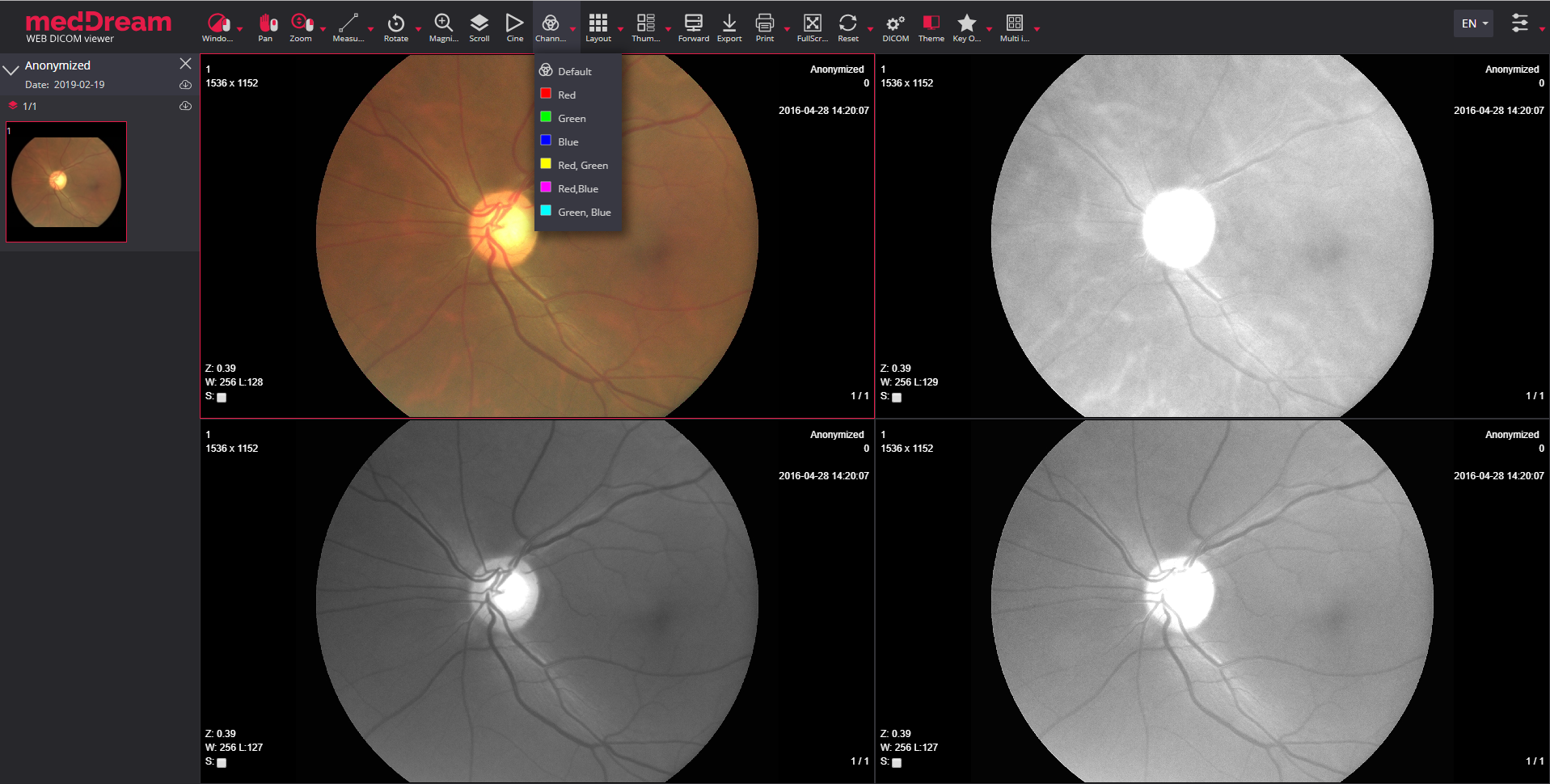 opthalmology html5 dicom viewer meddream