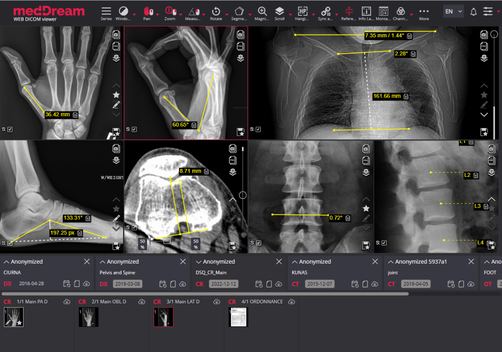 ortho measurements3