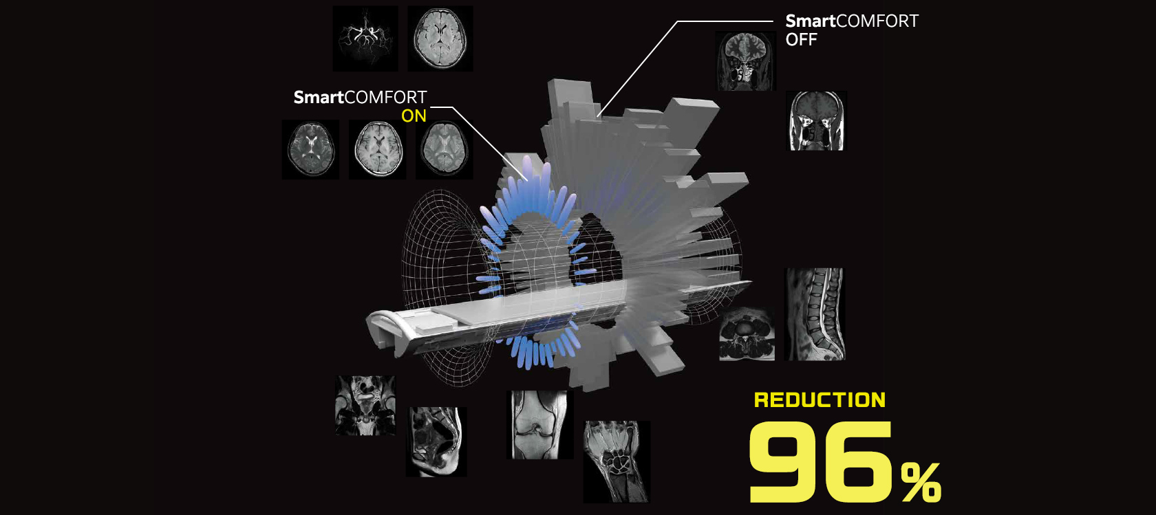 pic echelon smart 02